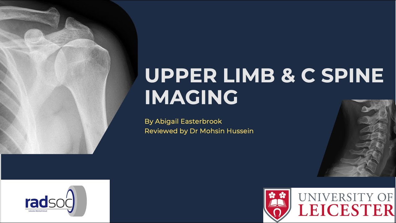 UoL RadSoc Teaching Series   Upper Limb & C spine Imaging