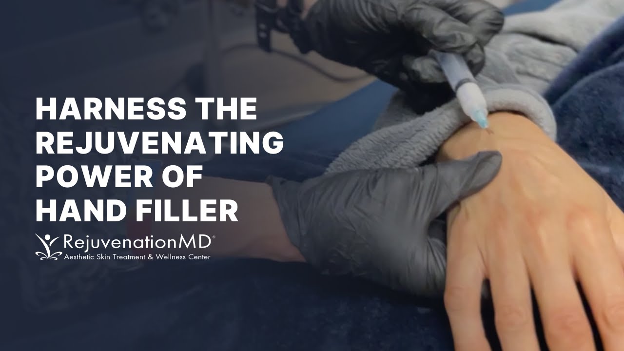 Revitalize Your Hands with Collagen-Stimulating Filler