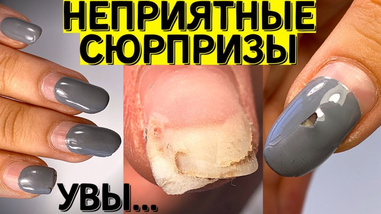 Сюрпризы под гель лаком 😲 Берегите ногти и делайте маникюр правильно!