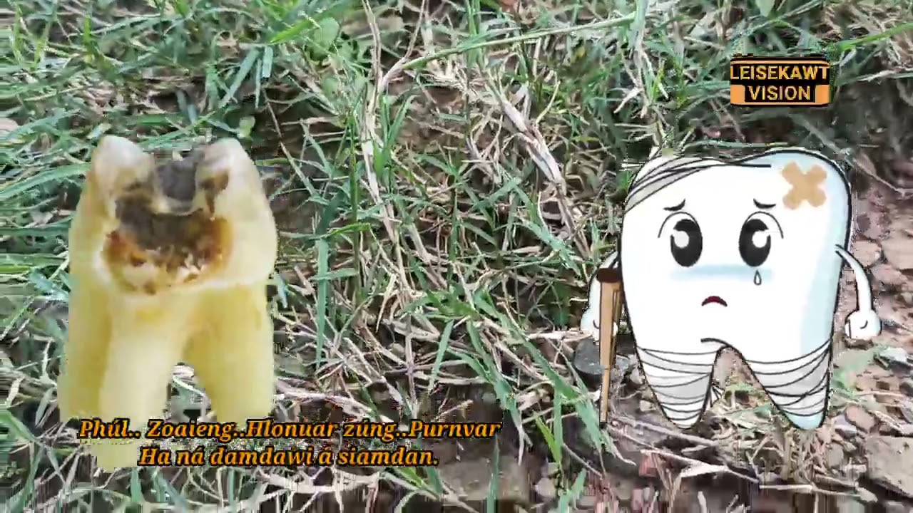 Ha ná damdawi ṭha em em..