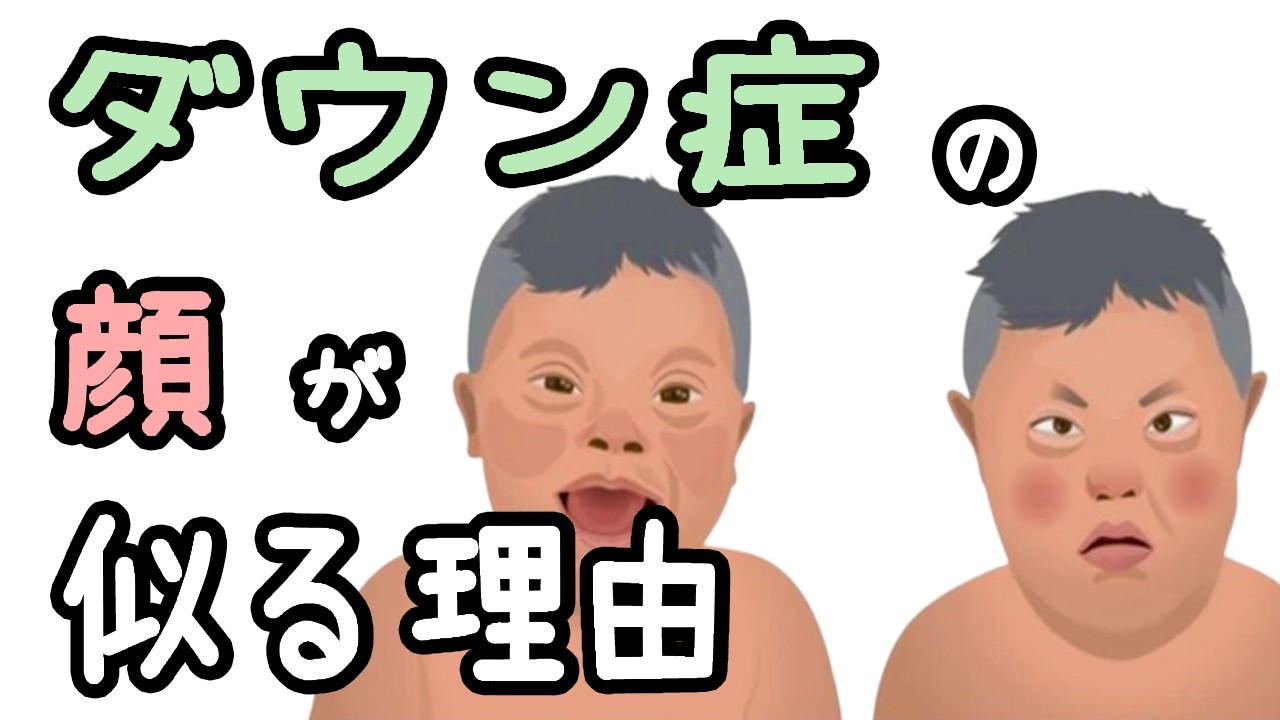ダウン症の顔つきが似る理由