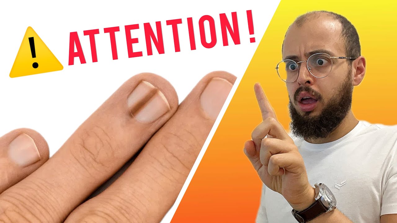 FAITES ATTENTION &Agrave; VOS ONGLES !