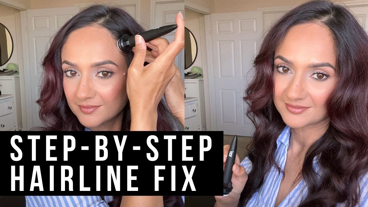 How to Regrow Your Hairline Naturally (Step by Step Routine)