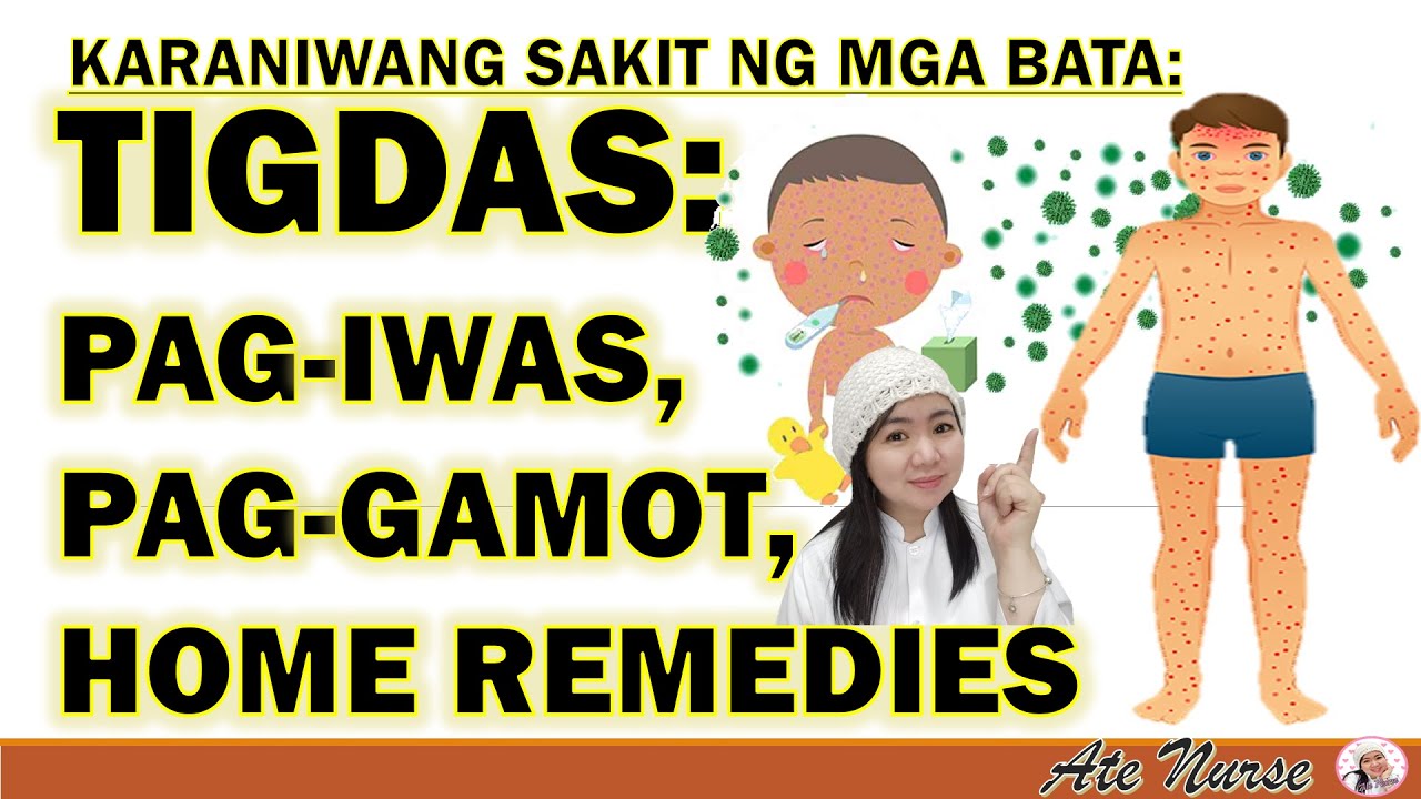 TIGDAS: MGA KUMPLIKASYON NG TIGDAS, PAGGAMOT SA TIGDAS, HOME REMEDIES I HEALTH TEACHINGS I ATE NURSE