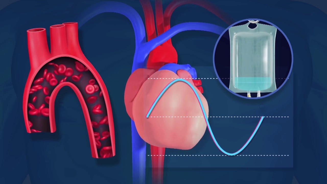 The CHEETAH NICOM™ Hemodynamic Monitoring System