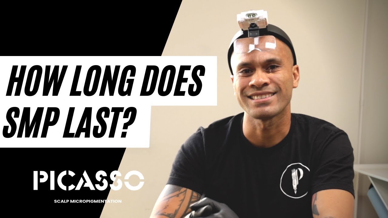 How Long Does Scalp Micropigmentation Last?