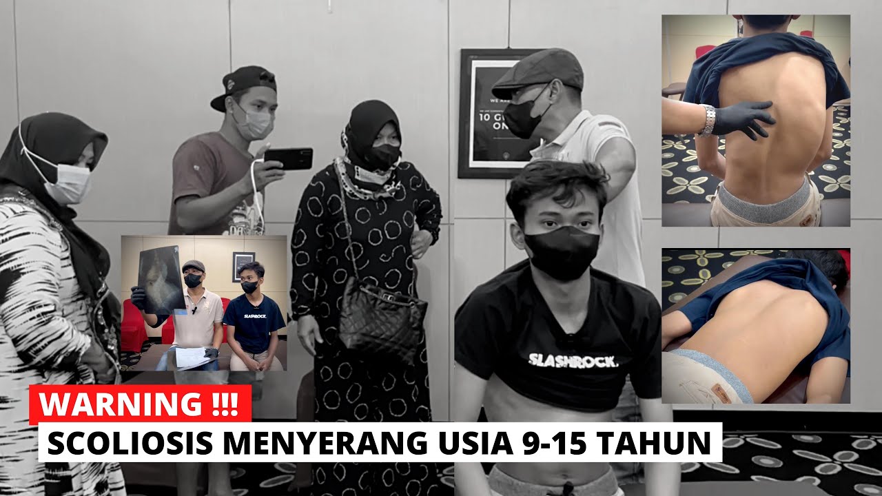 TREATMENT SKOLIOSIS BENTUK S, MRM ROAD SHOW SEMARANG #3