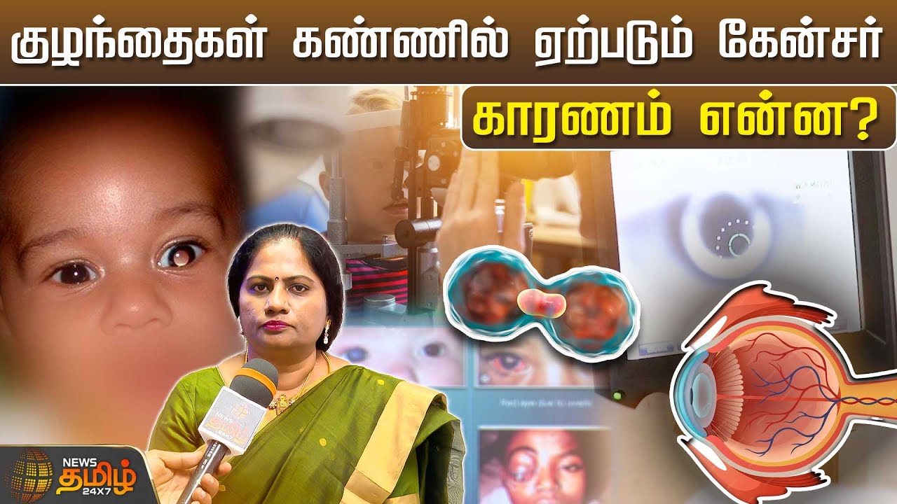 குழந்தைகள் கண்ணில் ஏற்படும் கேன்சர் காரணம் என்ன? | Cancer | Eye | Childrens | Dr. Suganeshwari
