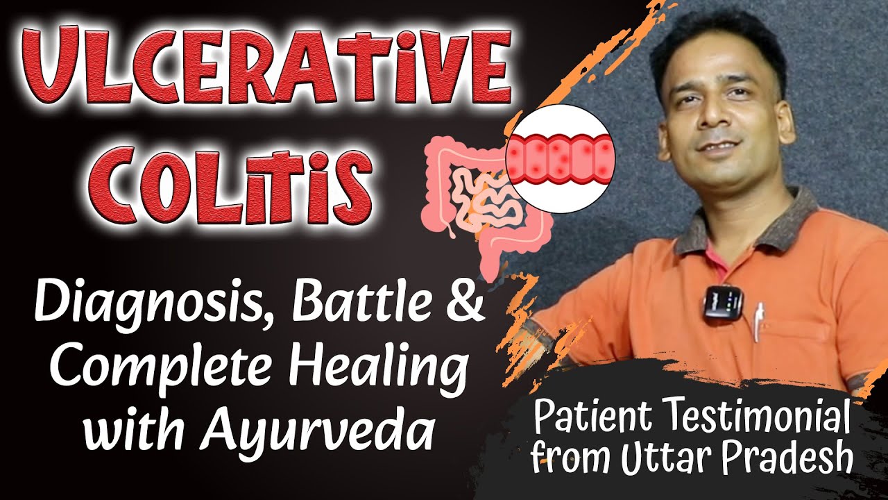 Ulcerative Colitis Diagnosis, Battle & Complete Healing with Planet Ayurveda  Review from UP India