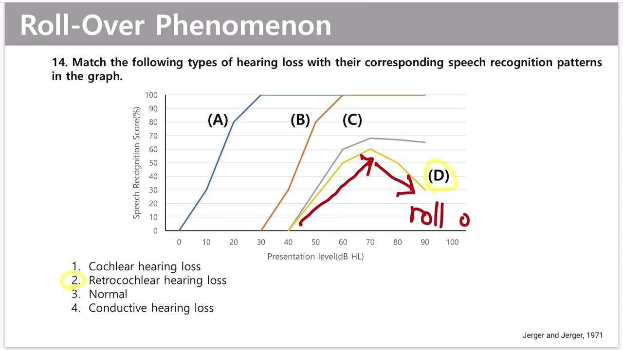 [Quiz] Speech Audiometry (2) Roll over phenomenon