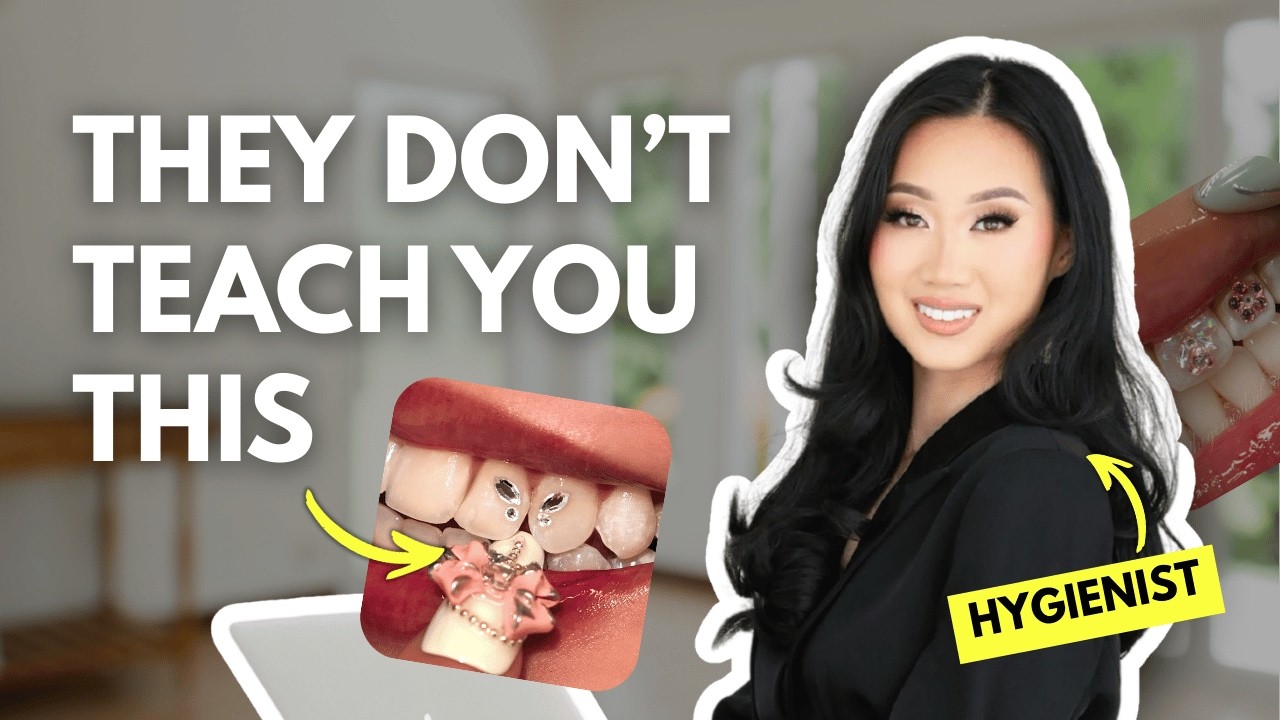 WATCH THIS if your tooth gems keep failing