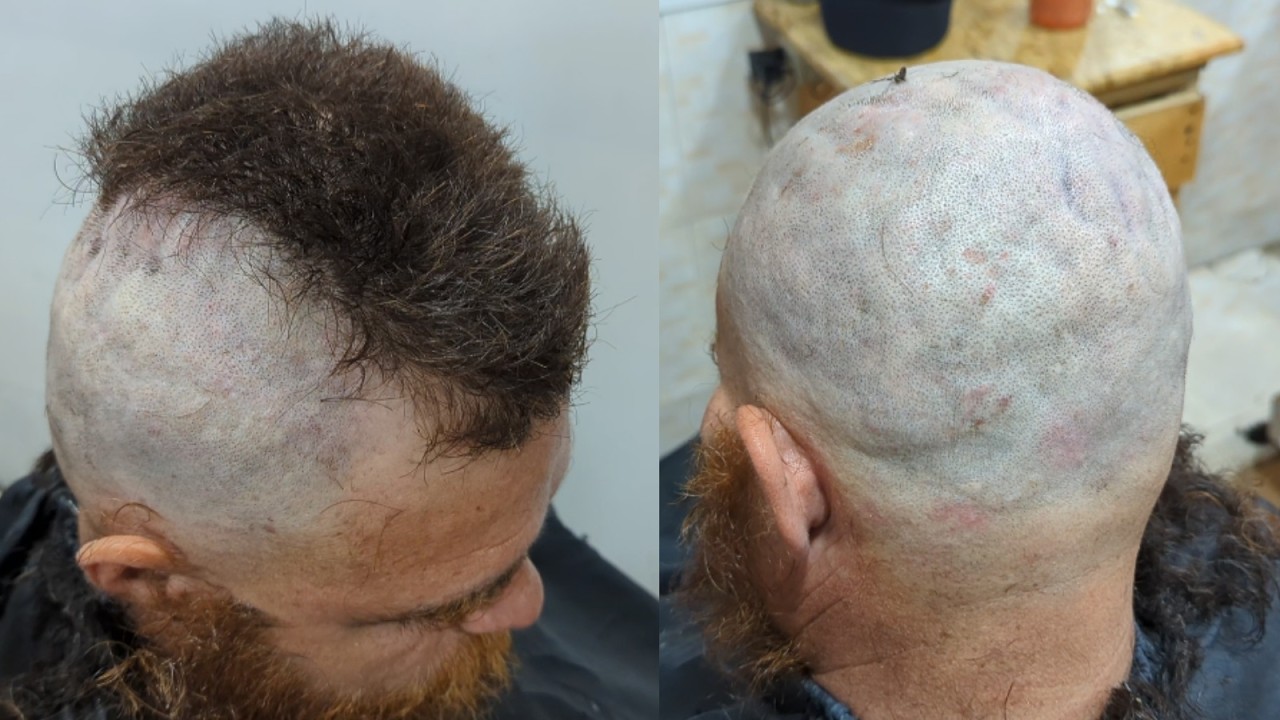 Attractive dandruff clean head shave straight razor ASMR transformation tutorial zaibi barber shop