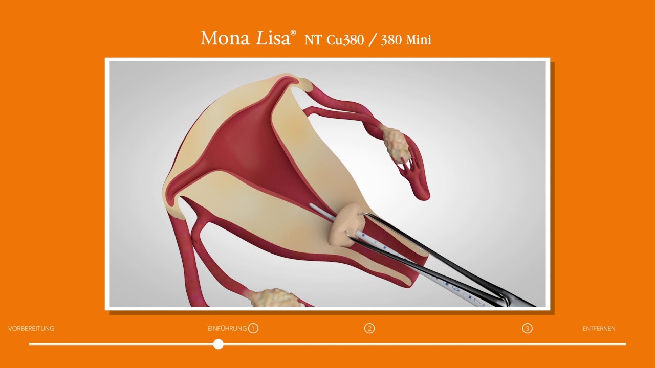 Mona Lisa NT Cu380/380 Mini Einführanleitung