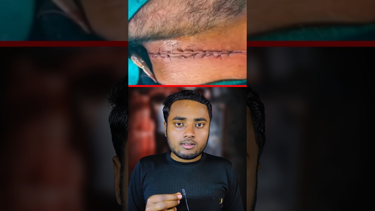 People are losing their lives due to Chinese manjha.