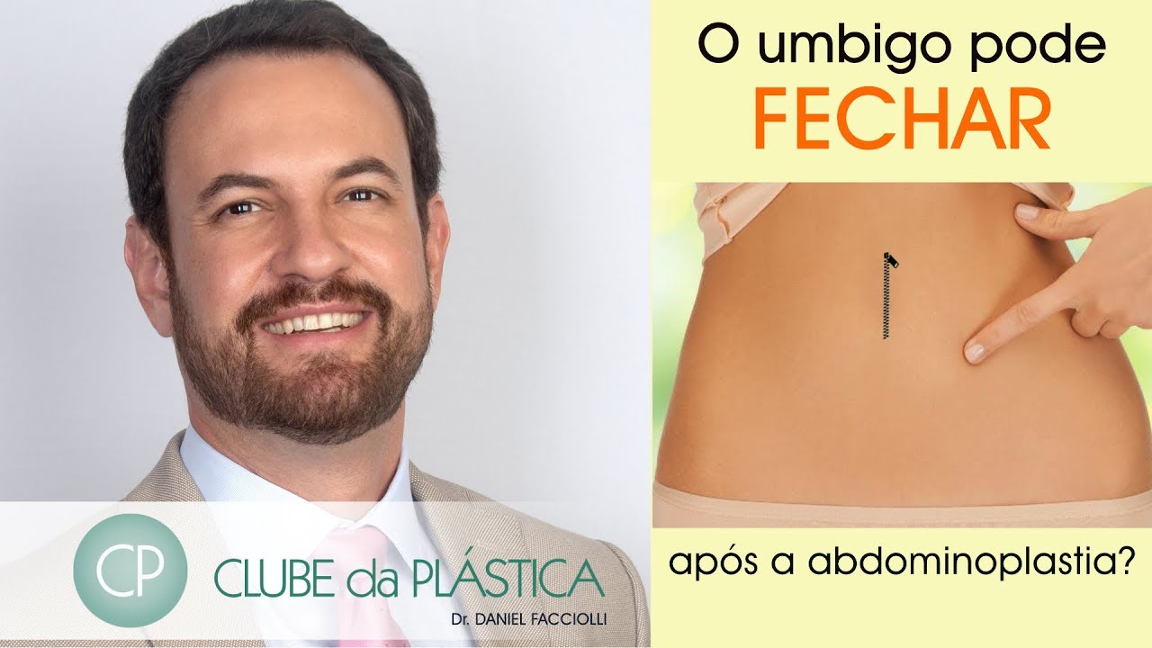 Clube da Plástica: O umbigo pode fechar após uma abdominoplastia?