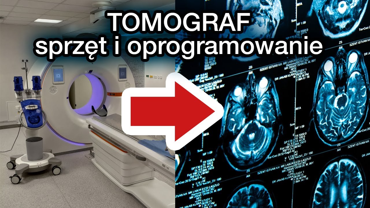 Jak działa tomografia komputerowa?