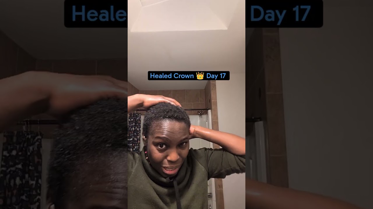 Healed Crown 👑 Day 17