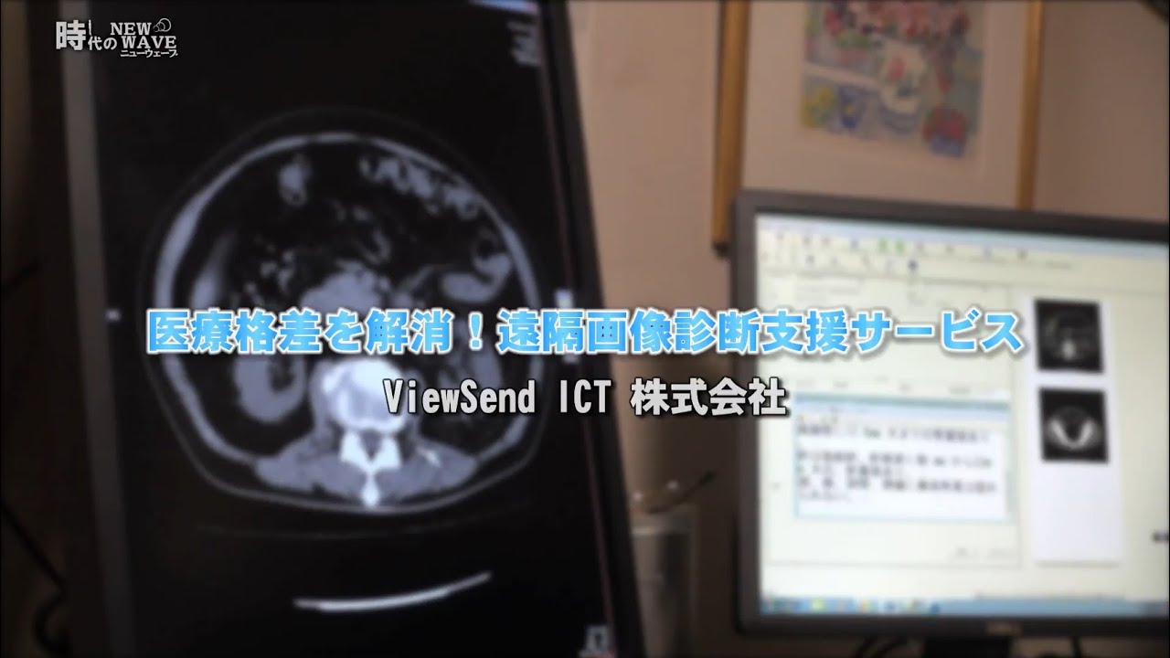 医療格差を解消！遠隔画像診断支援サービス