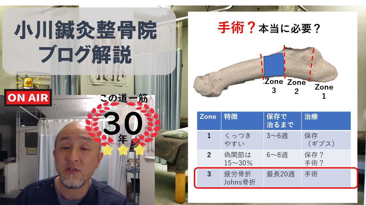 No.1第5中足骨基底部骨折について