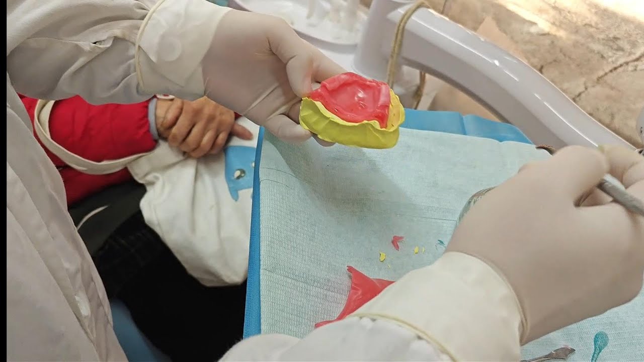 Impression taking and bite wax fabrication.#SatisfyingProcess#Dentist