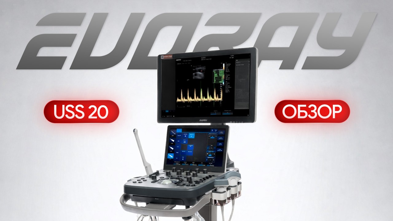 EVORAY USS 20: обзор УЗИ аппарата и примеры исследований
