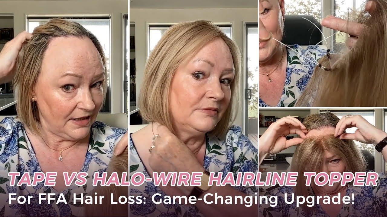 TAPE vs HALO-WIRE Hairline Topper for FFA Hair Loss: Game-Changing Upgrade! | UniWigs Evelyn