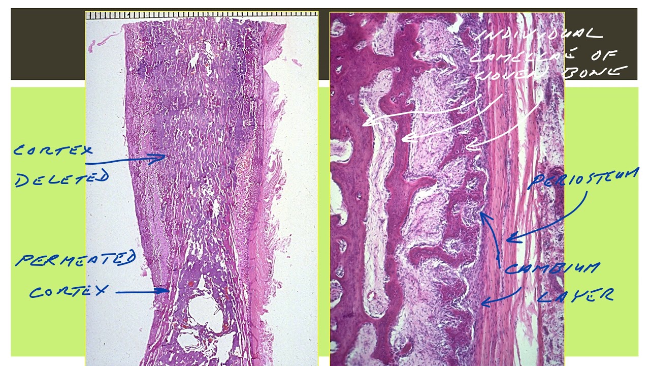 Osteogenesis 1 - Basic Concepts