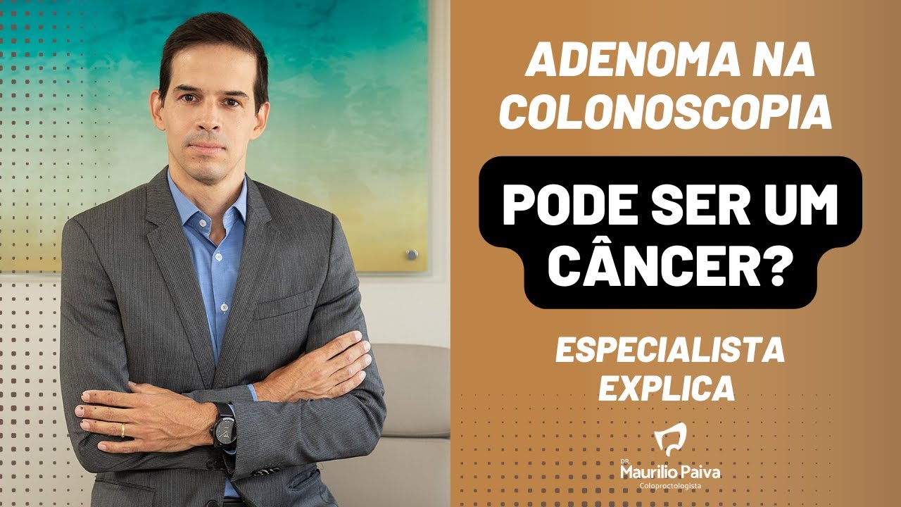 Adenoma na colonoscopia: PODE SER UM CÂNCER?