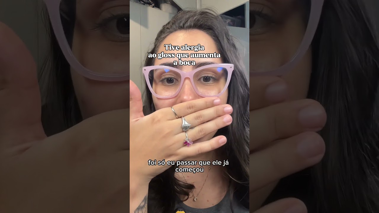 Tive alergia ao Gloss que aumenta a boca - Vivai SOS boc&atilde;o #maquiagem
