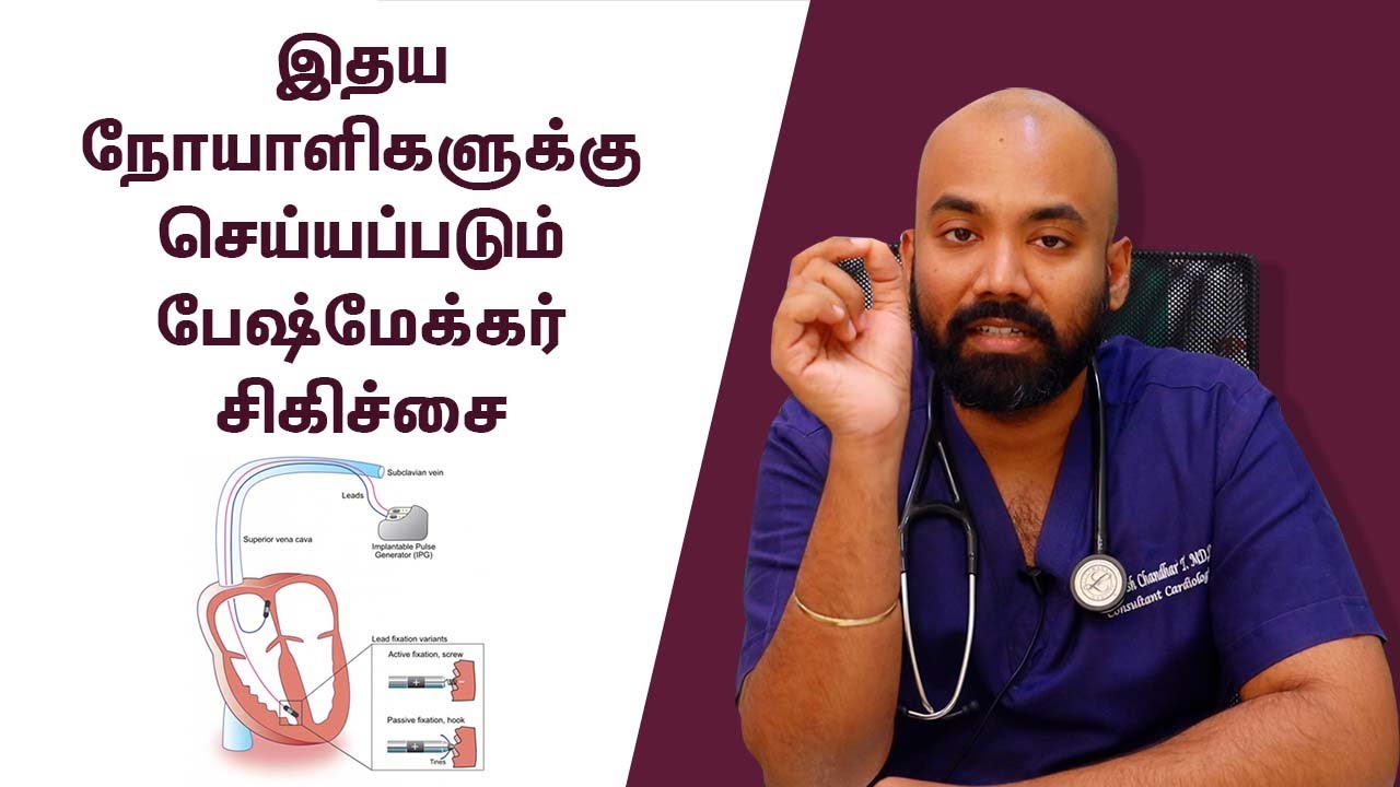 What is Pacemaker Treatment for Heart Diseases | இதய நோயாளிகளுக்கு செய்யப்படும் பேஷ்மேக்கர் சிகிச்சை