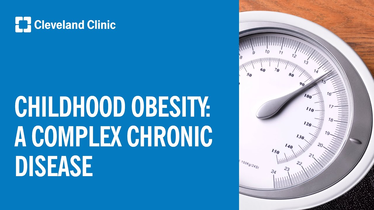 Childhood Obesity: A Complex Chronic Disease