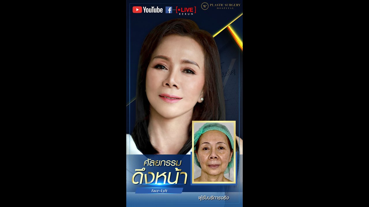 ศัลยกรรมดึงหน้า‼ ผลลัพธ์ 1 เดือน ของคุณวันเพ็ญ”(ผู้ใช้บริการจริง