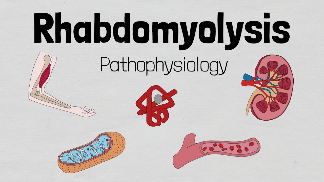 Rhabdomyolysis: Pathophysiology