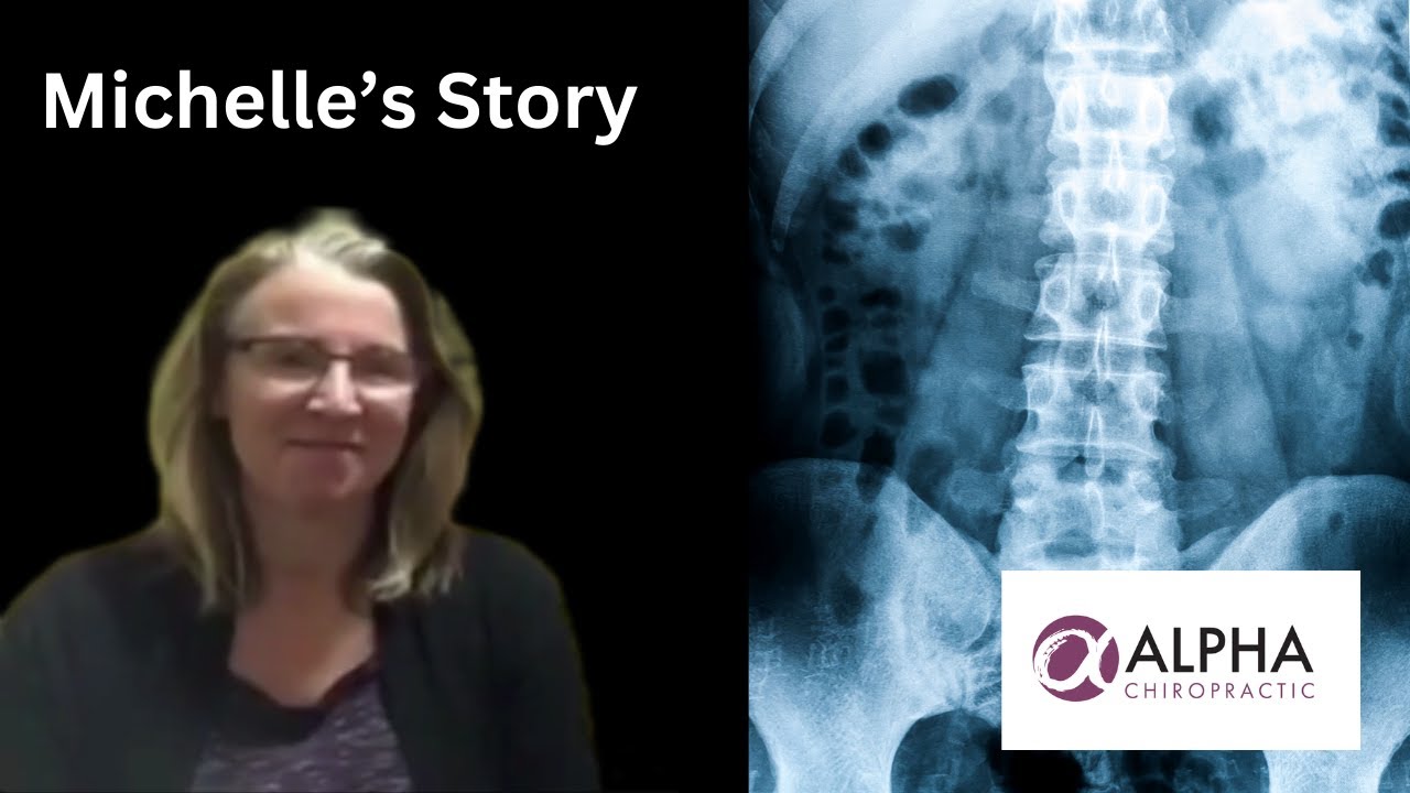 Michelle's Story | Chiropractic Spinal Reconstruction | Dr. Tyler Jones | Alpha Chiropractic