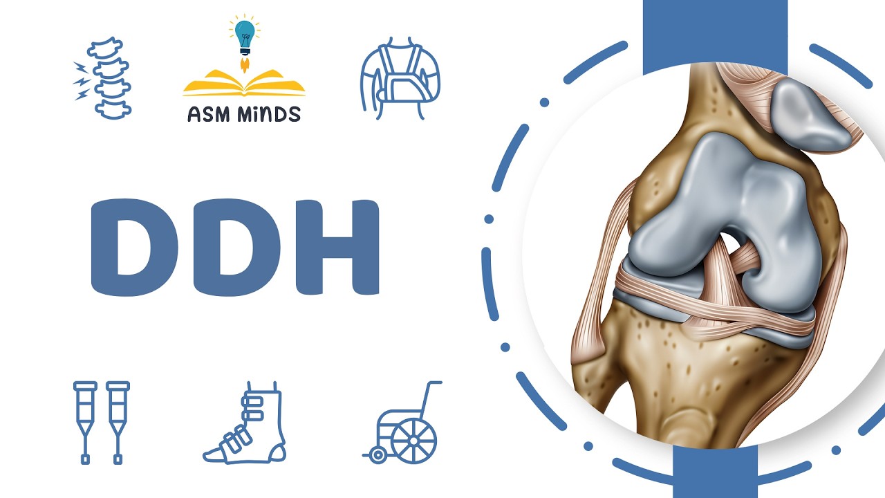 20- DDH - Orthopedics Course - By Dr.Nada Ali