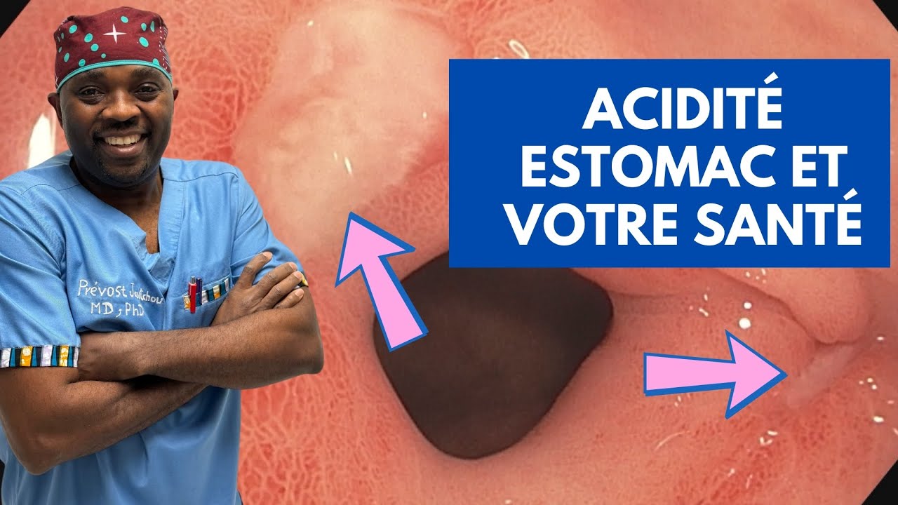 Tout savoir sur l’acidité de l’estomac, le mal gastrique et votre santé par @Docteur Sourire