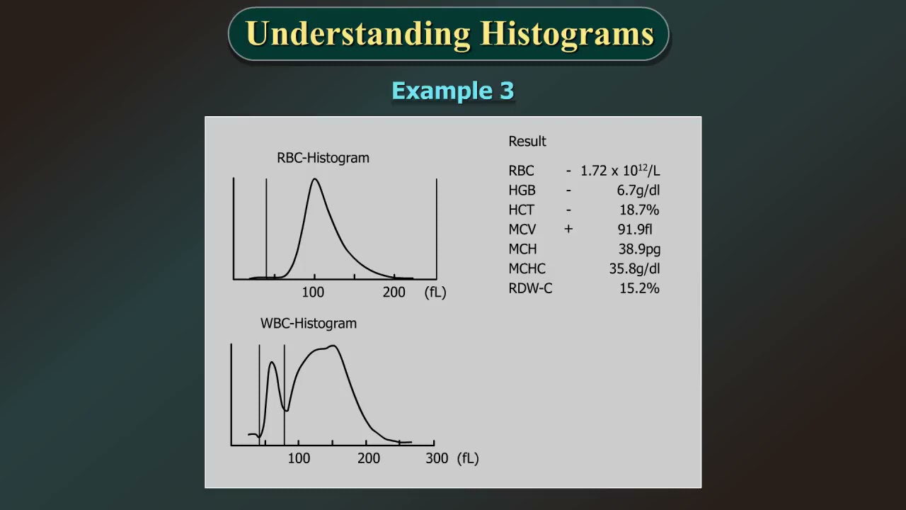 CBC Analyzer Part 6b   Examples of Histograms