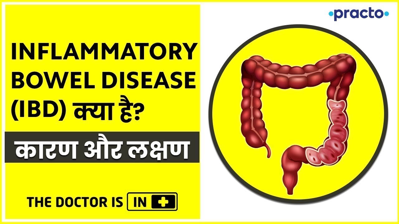 What Is Ulcerative Colitis (Hindi)? Ulcerative Colitis Causes, Signs & Symptoms | Practo