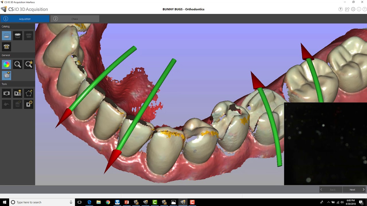 CS 3600 - Identifying, Fixing, and Preventing Stitching Errors