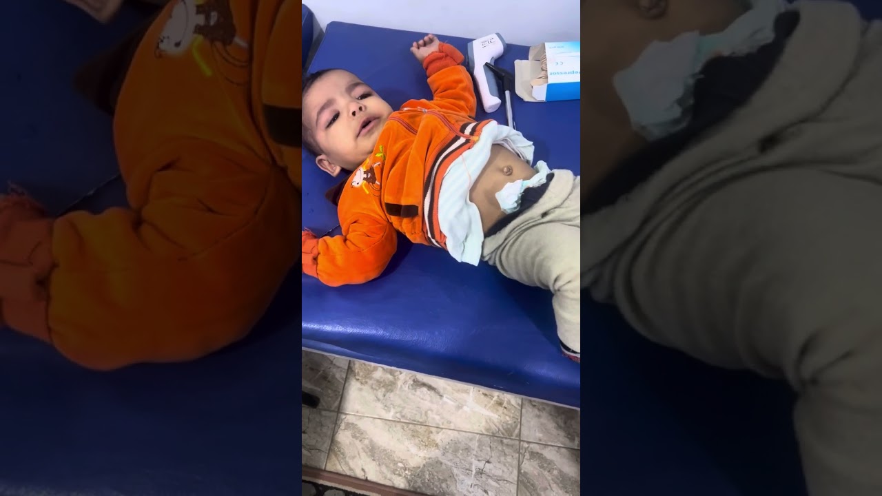 النزلات المعوية في الاطفال اللي عندهم #حساسية_الألبان