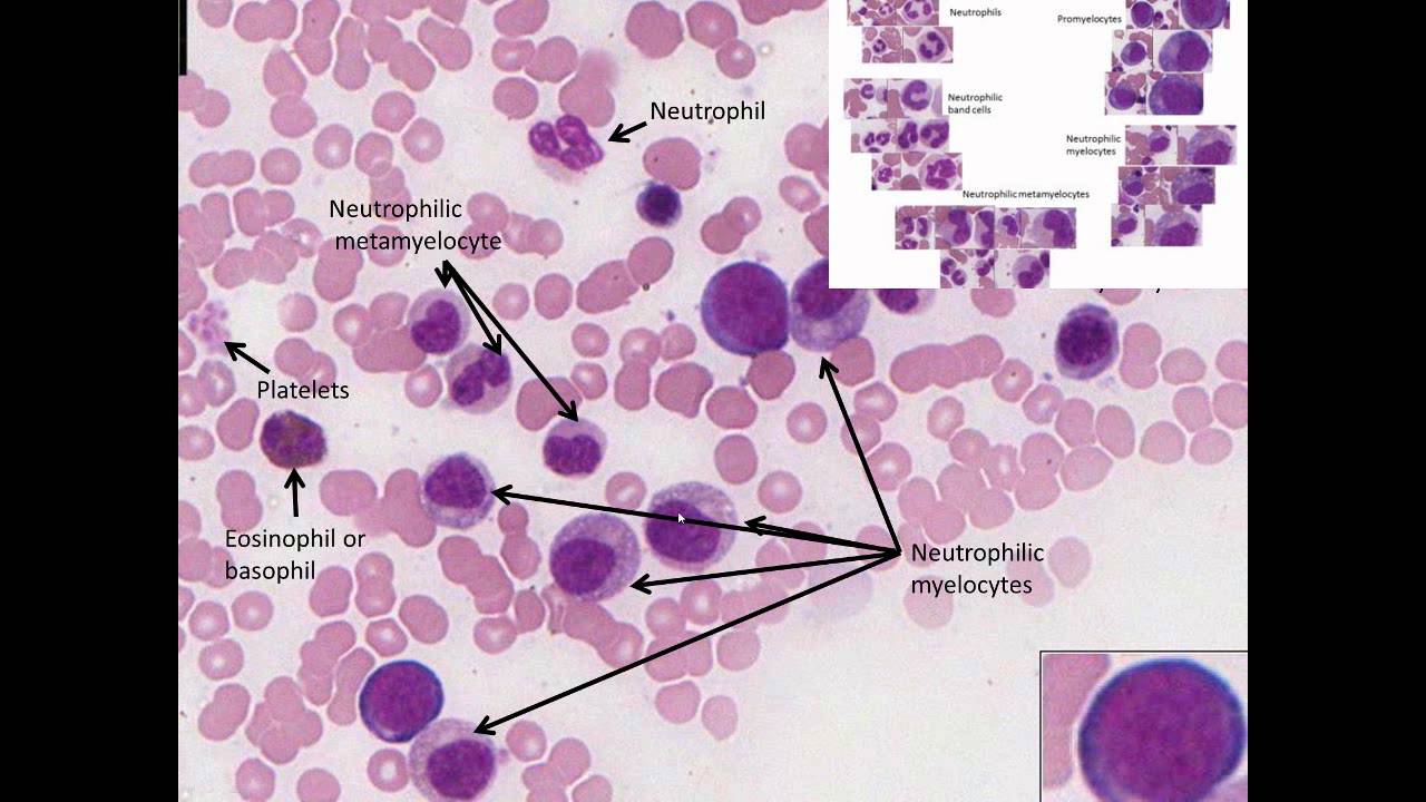 Hematopoiesis Simplified  - Part 2 Granulopoiesis
