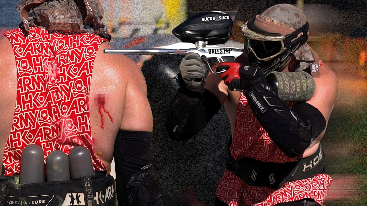 THE MOST BRUTAL PAINTBALL HIT I HAVE EVER GOTTEN...