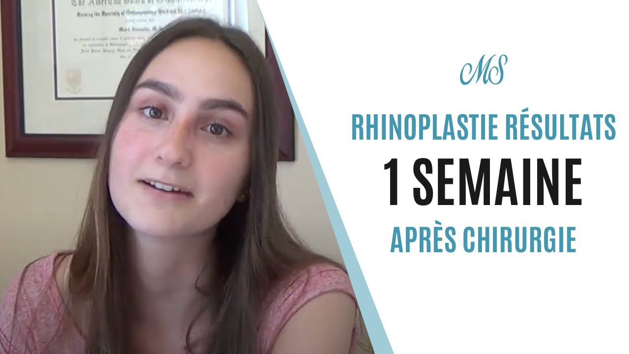 Résultats d’une rhinoplastie 1 semaine après l’opération faite à Montréal | Dr. Mark Samaha