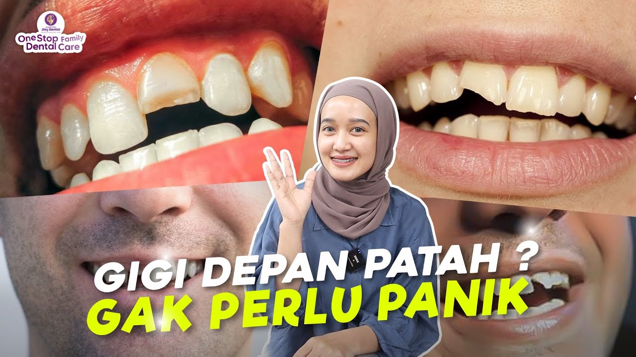 5 CARA MENNGATASI GIGI DEPAN PATAH. APA SAJA YA ?