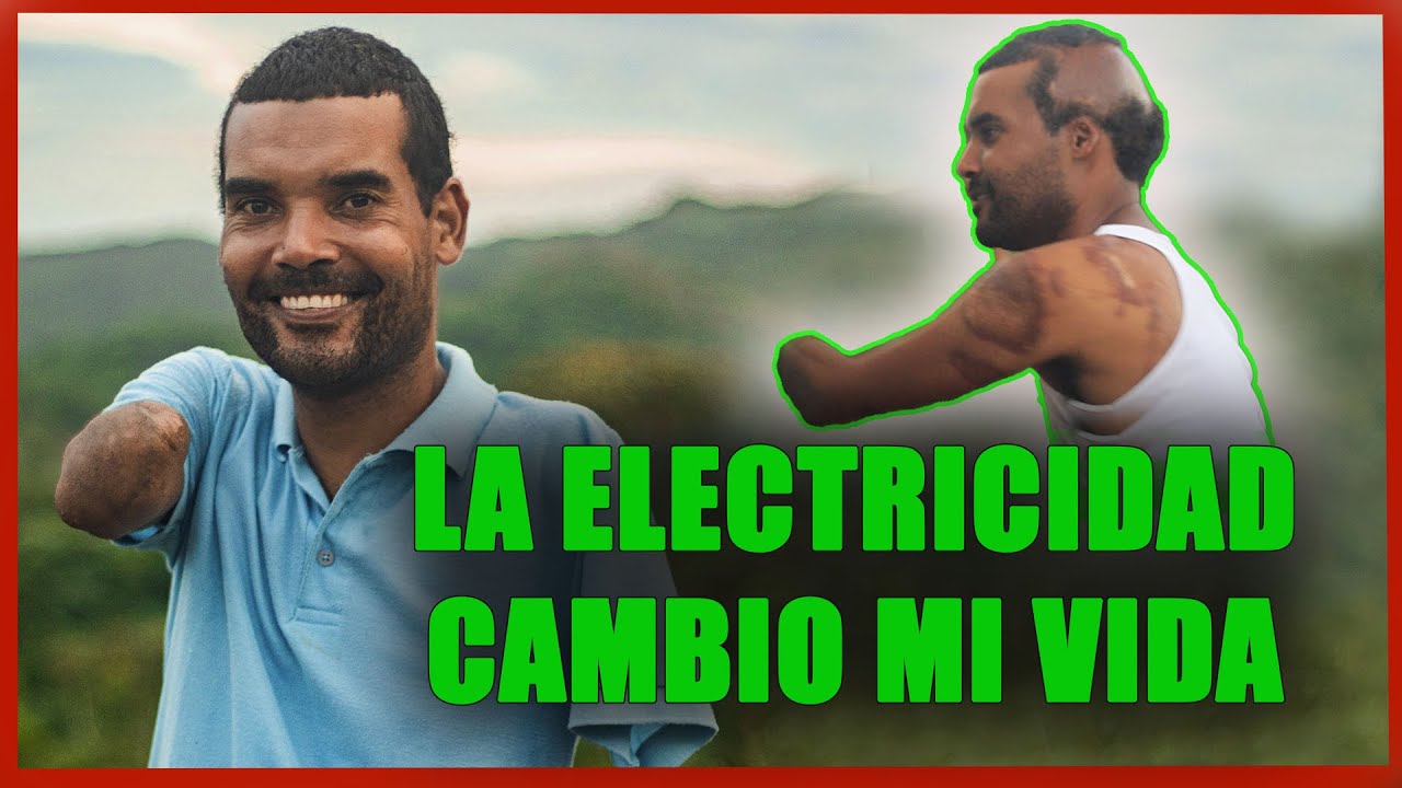 Sus suegros lo rechazaron por su condición física hasta que conocieron quien era realmente.