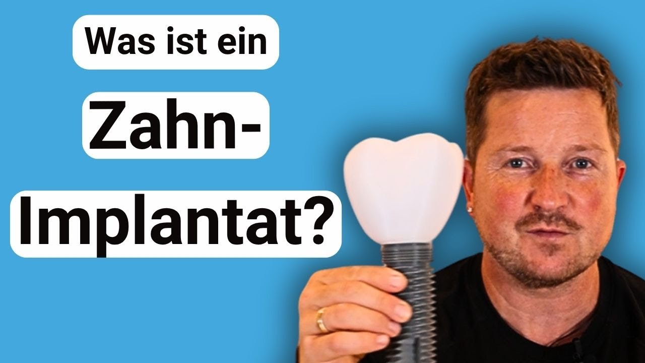 Was ist ein Zahn-Implantat?