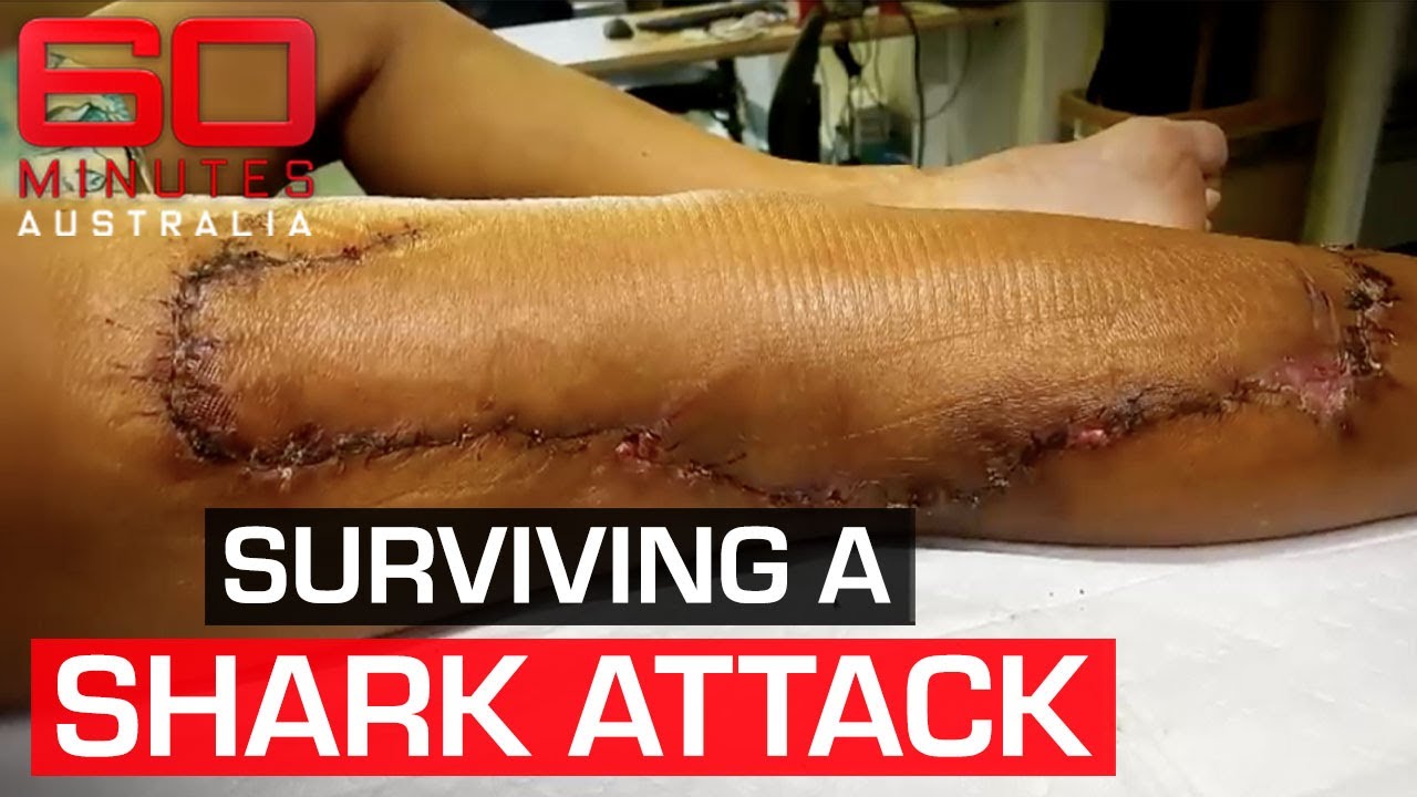 What saved a woman's life when a shark attacked in shallow waters | 60 Minutes Australia
