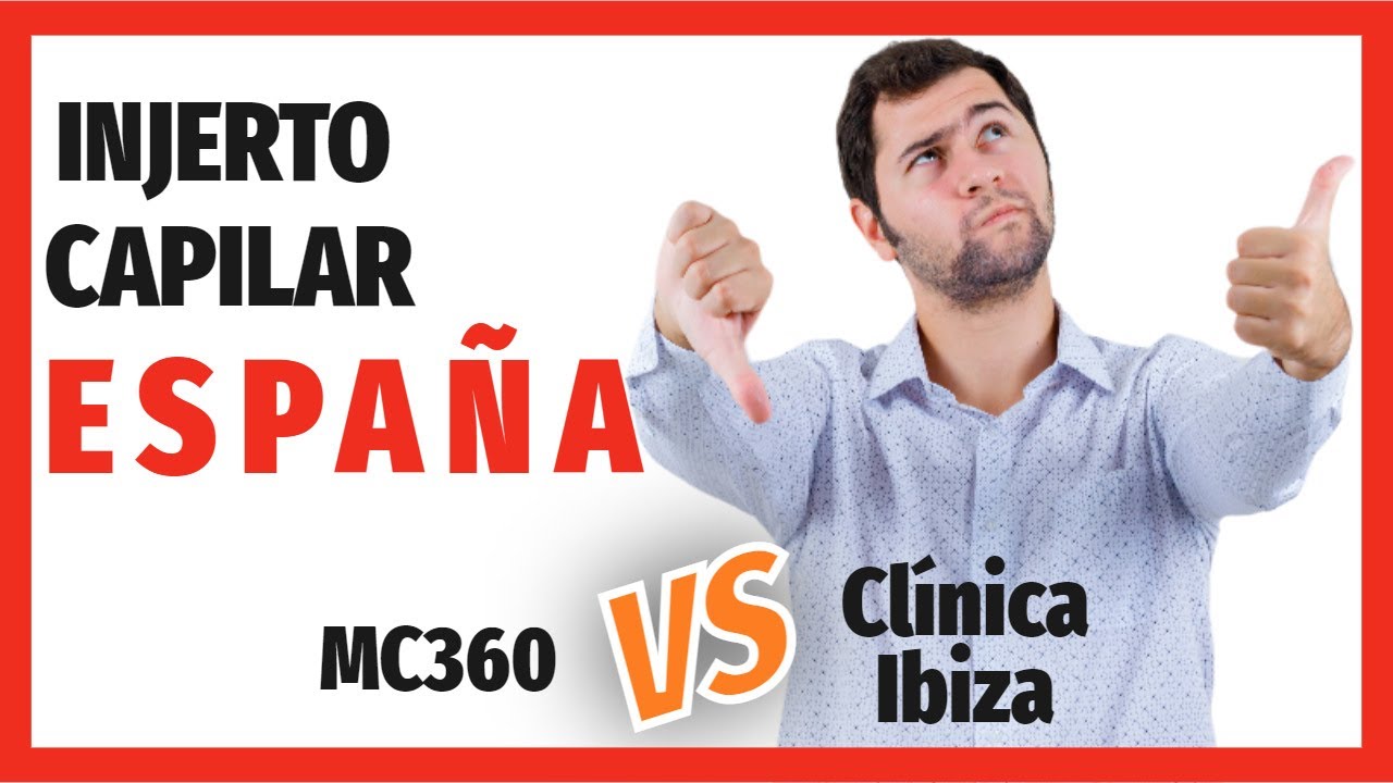 MC360 vs Cl&iacute;nica Ibiza  | OPINIONES Injerto Capilar
