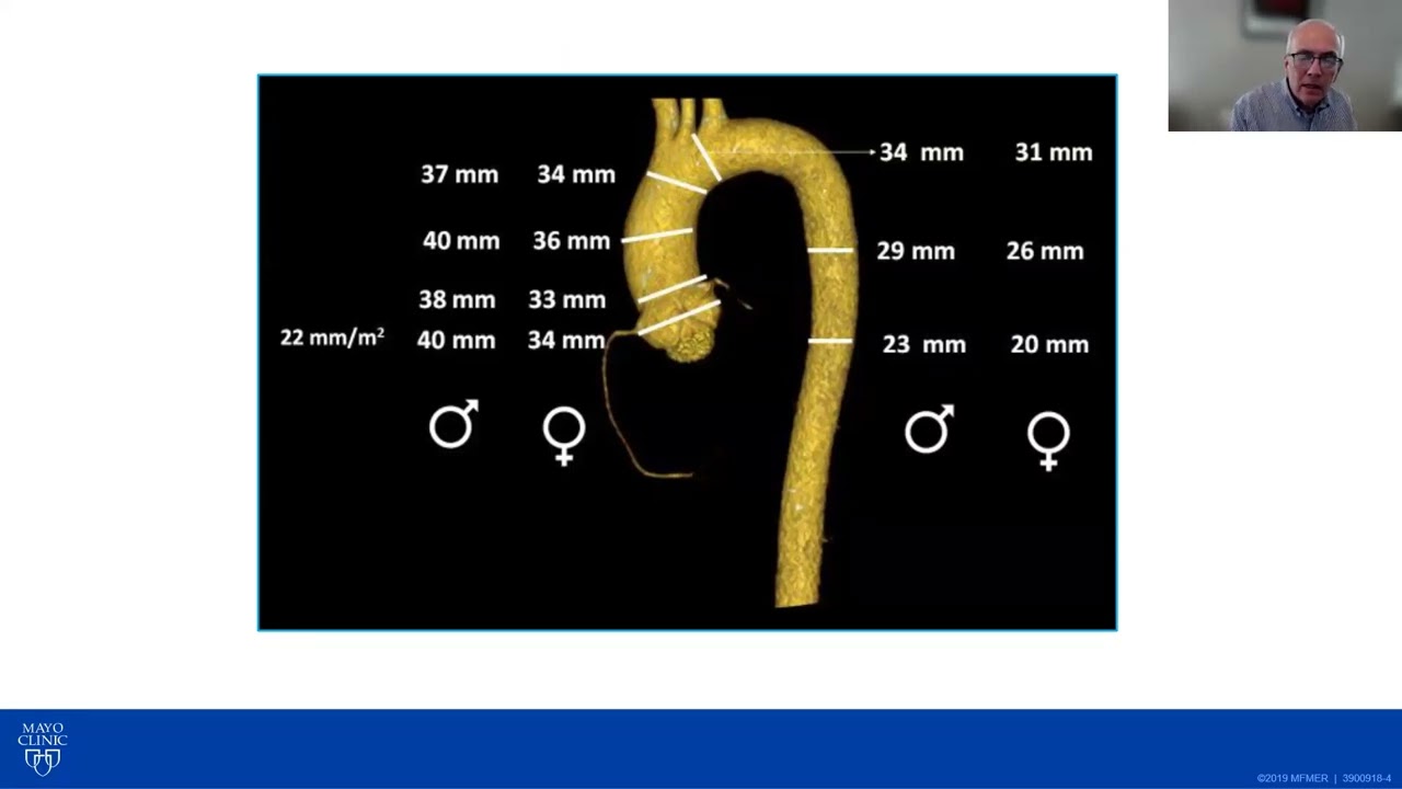 Aorta and Aneurysm Definitions