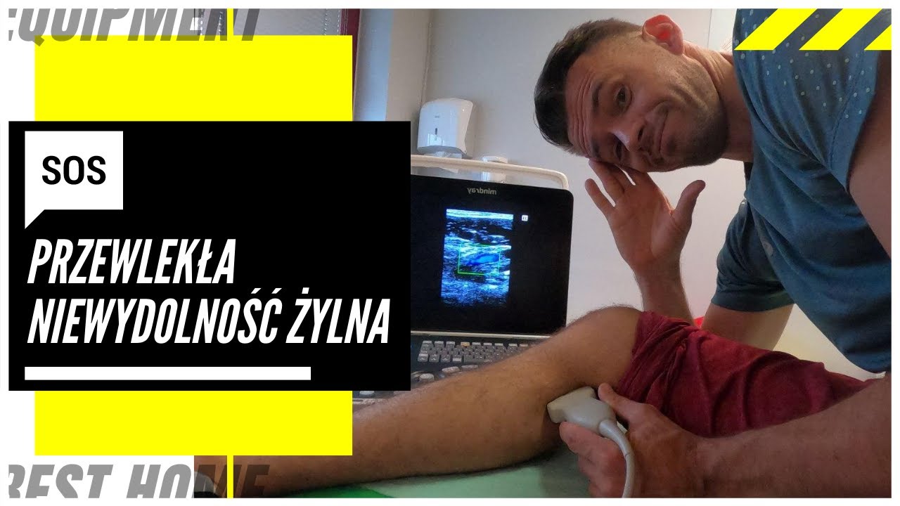 Zmęczone i ciężkie nogi? Przewlekła niewydolność żylna czyli pajączki, żylaki i inne takie...
